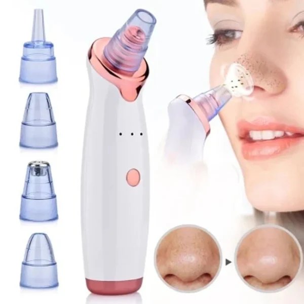 Máquina Sucção A Vácuo Remove Cravo Aparelho Acne Cleaning - Imagem 2